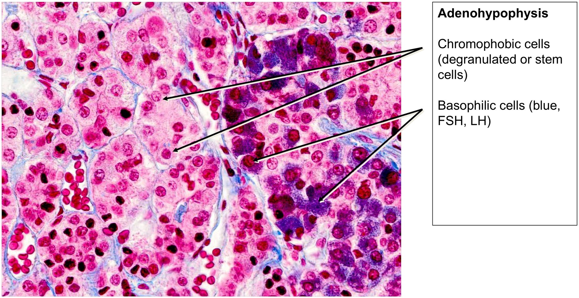 Pituitary gland (Hypophysis)