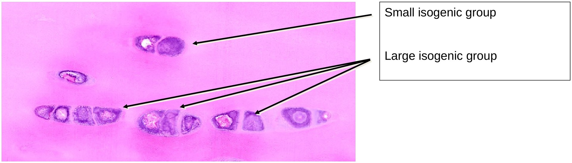 Hyaline cartilage (Rib)