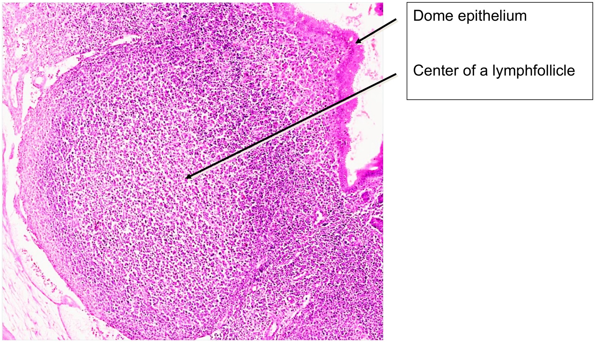Ileum, Peyer’s patches