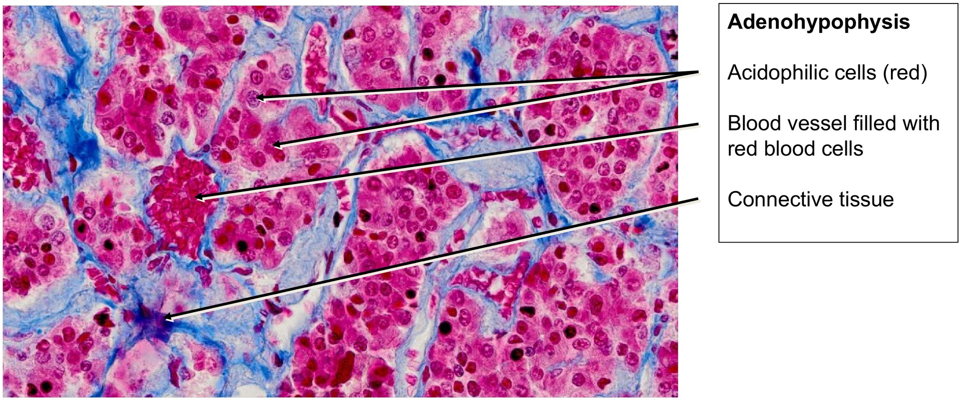 Pituitary gland (Hypophysis)