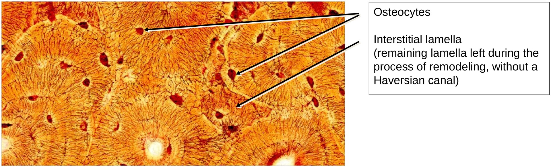 Lamellar bone (Dog, Tibia)