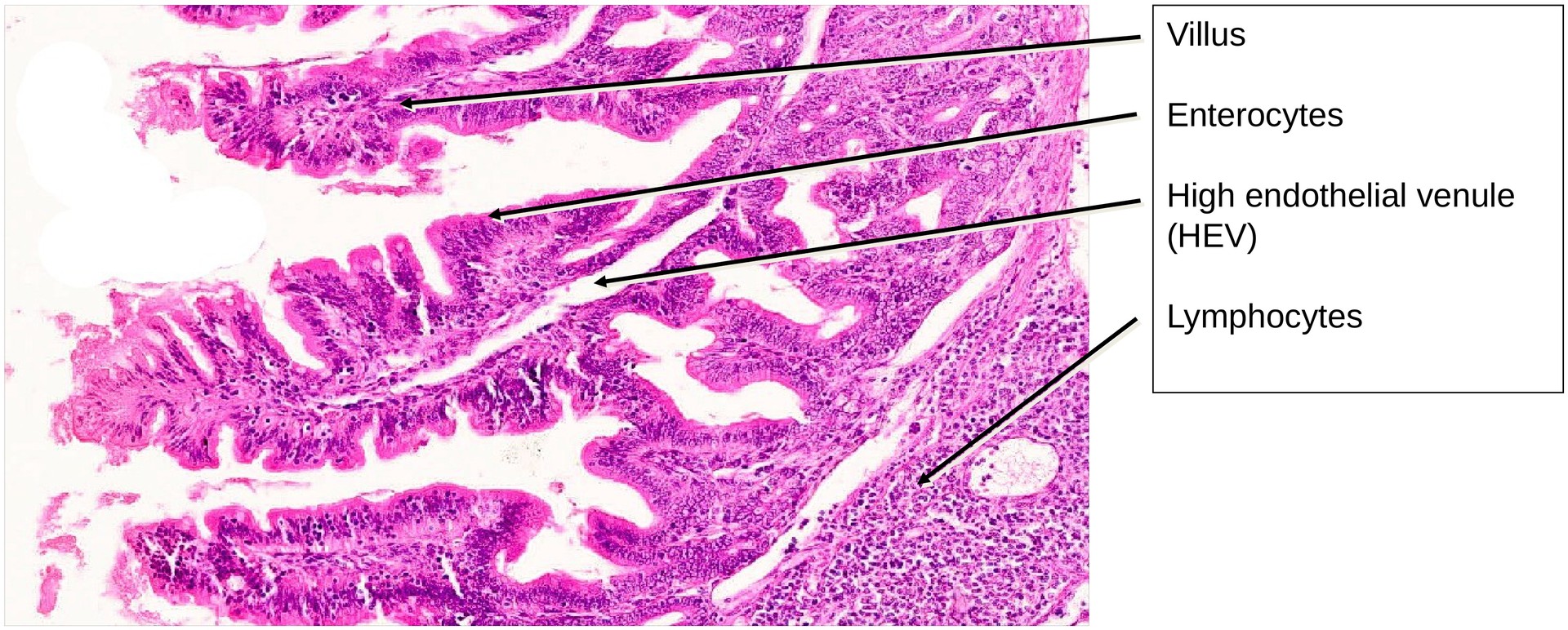 Ileum, Peyer’s patches