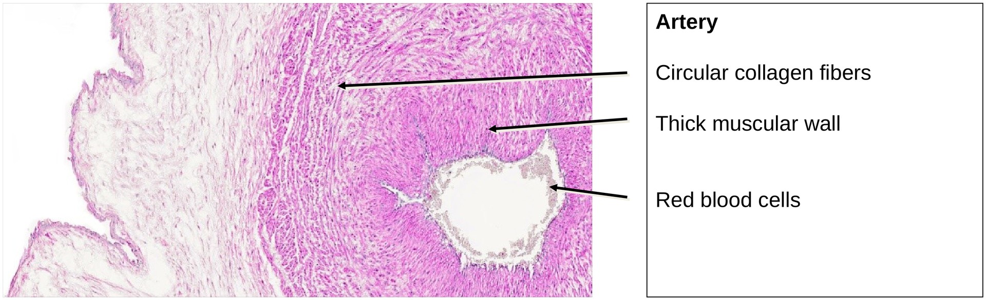 Fetal connective tissue (Umbilical Cord)