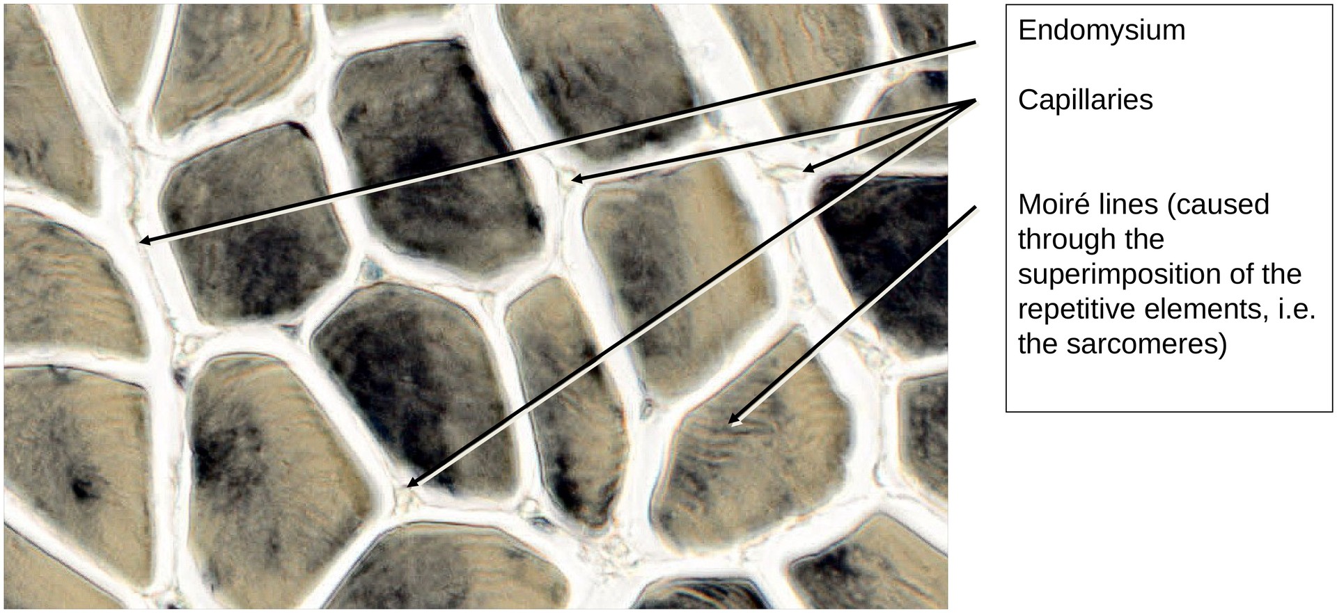 Skeletal muscle (transverse)