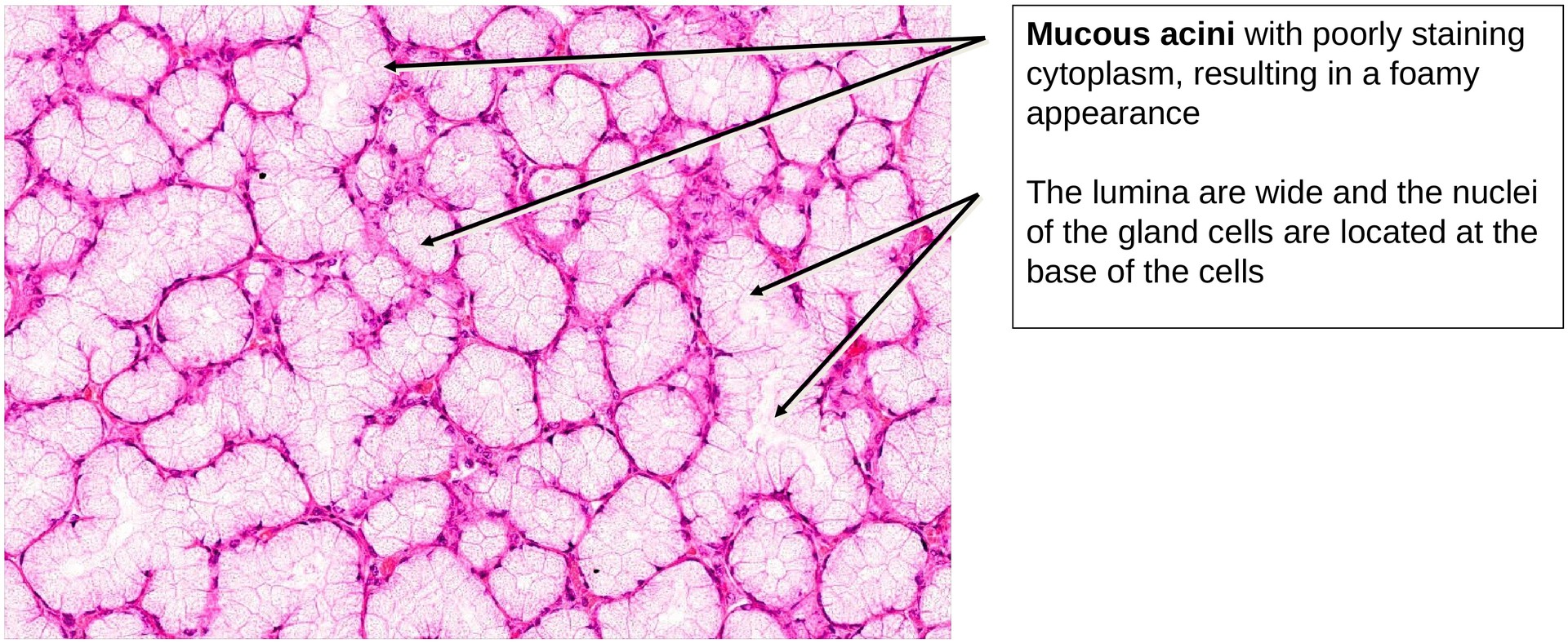 Sublingual gland