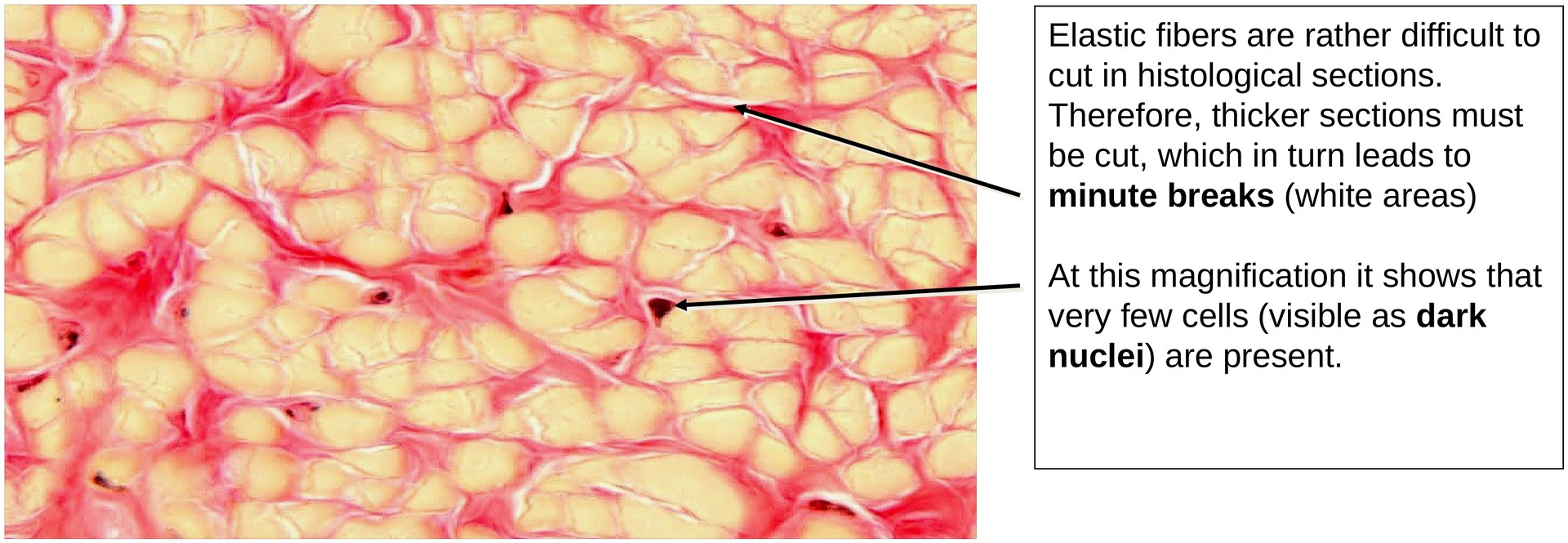 Elastic fibers (Nuchal ligament)