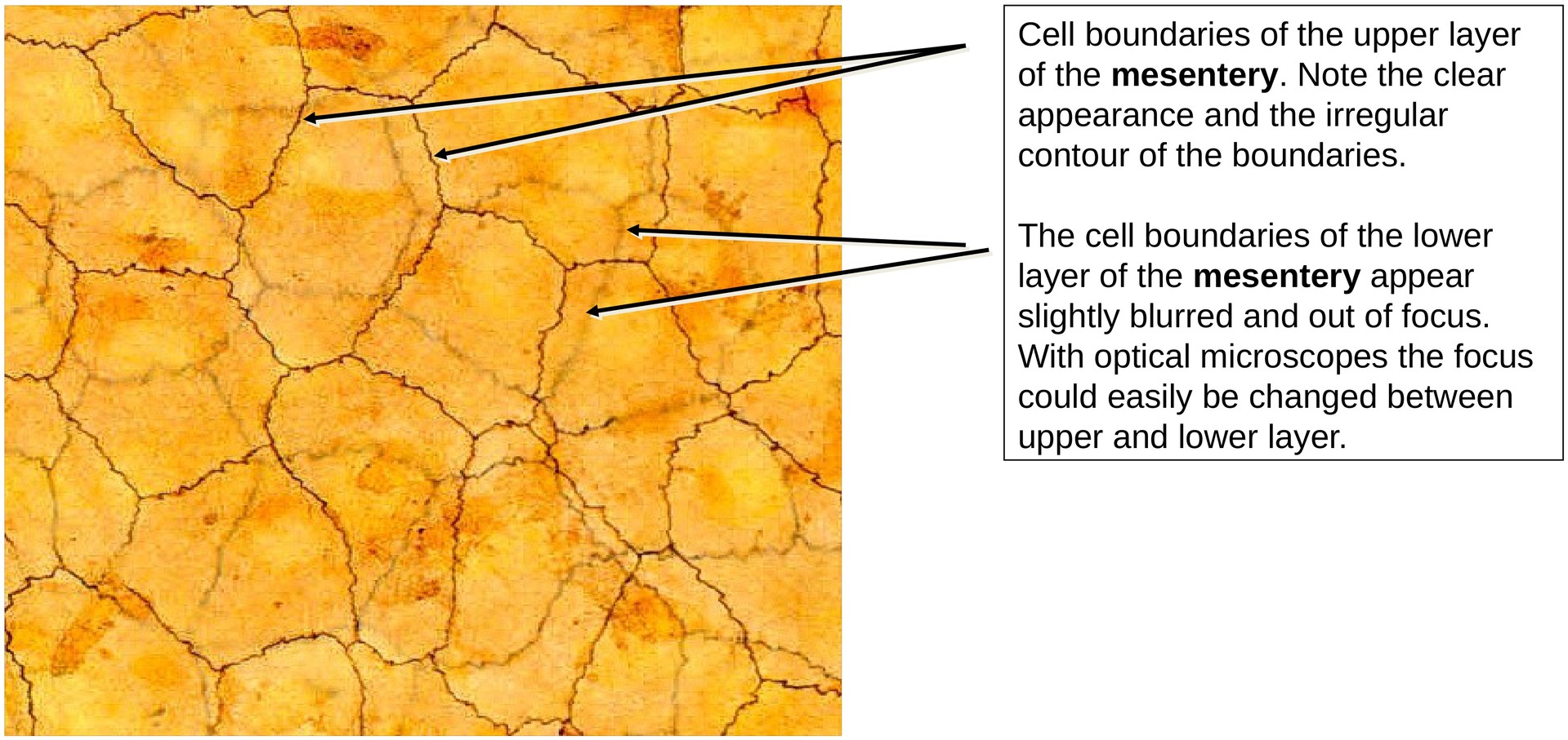 Cell boundaries (mesentery)