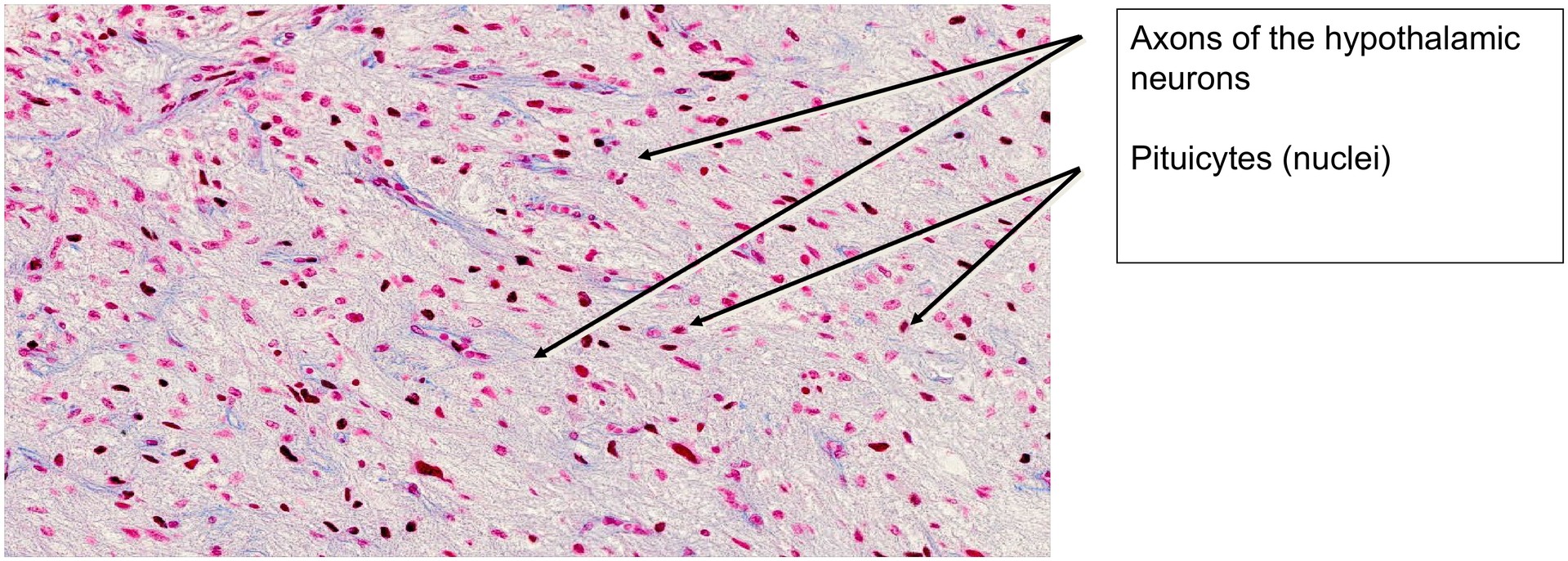 Pituitary gland (Hypophysis)