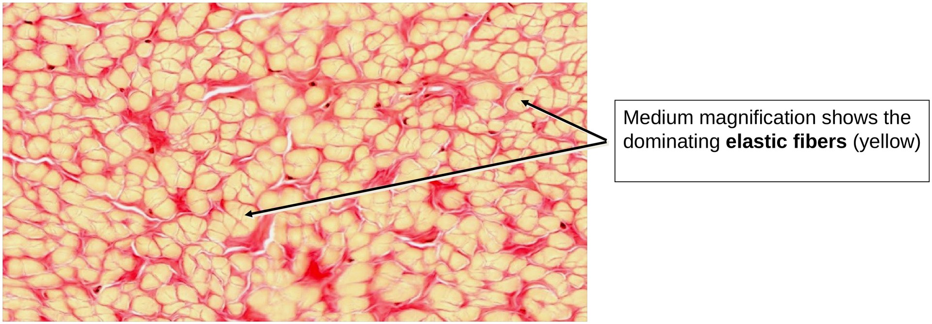 Elastic fibers (Nuchal ligament)