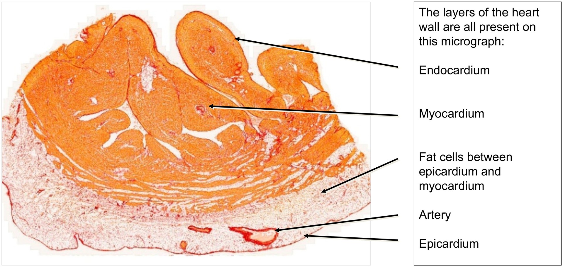 Cardiac muscle (Trabeculae)