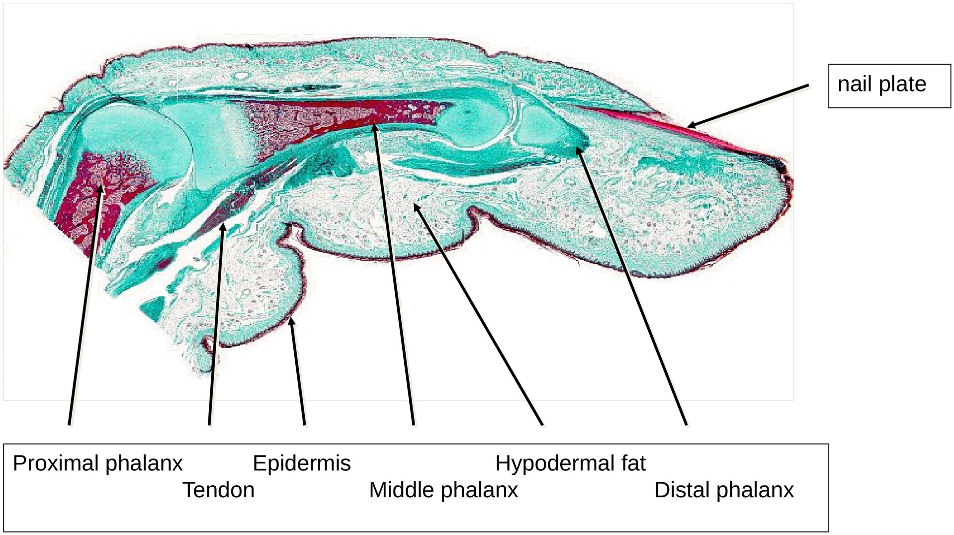 Ossification, perichondral (Finger)