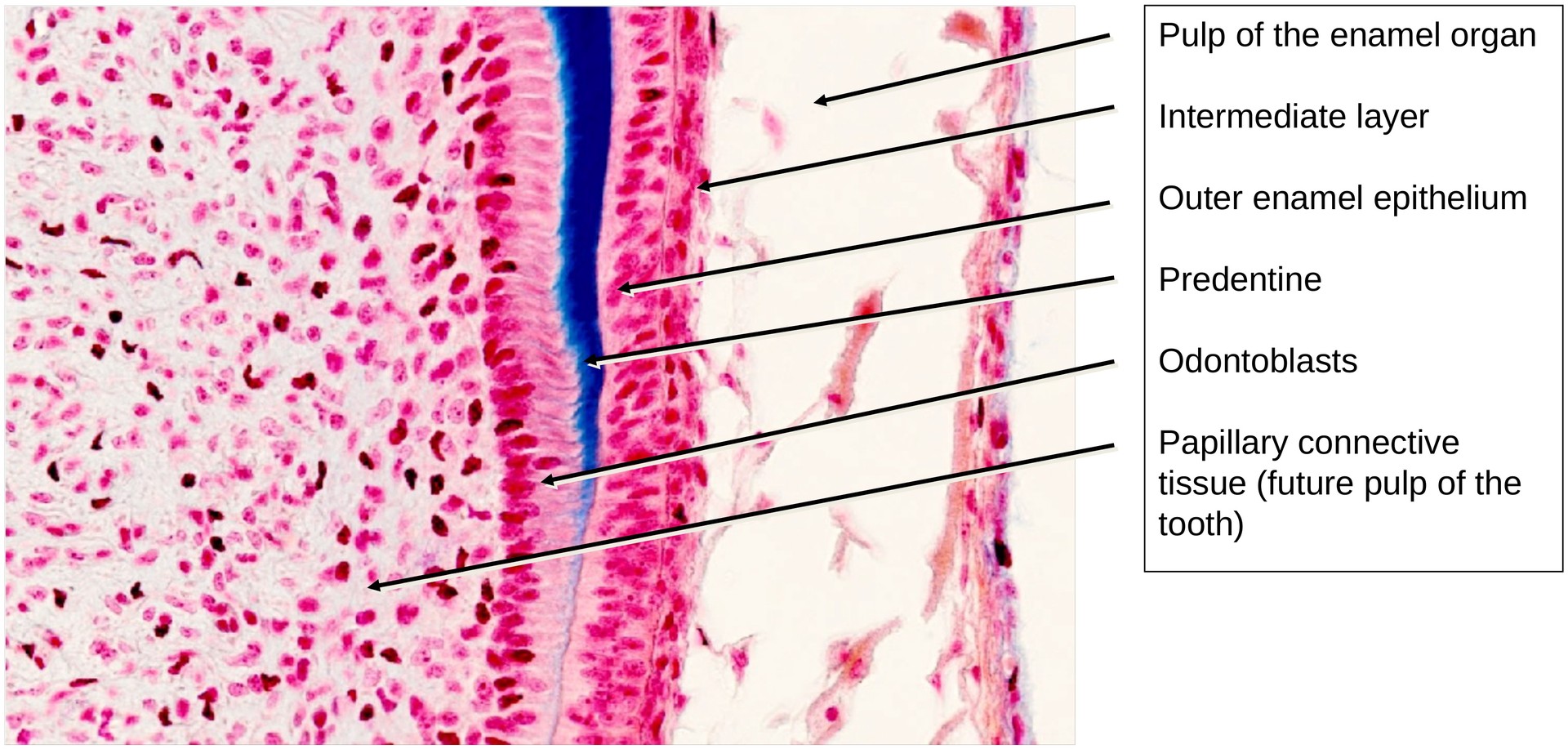 Tooth development II