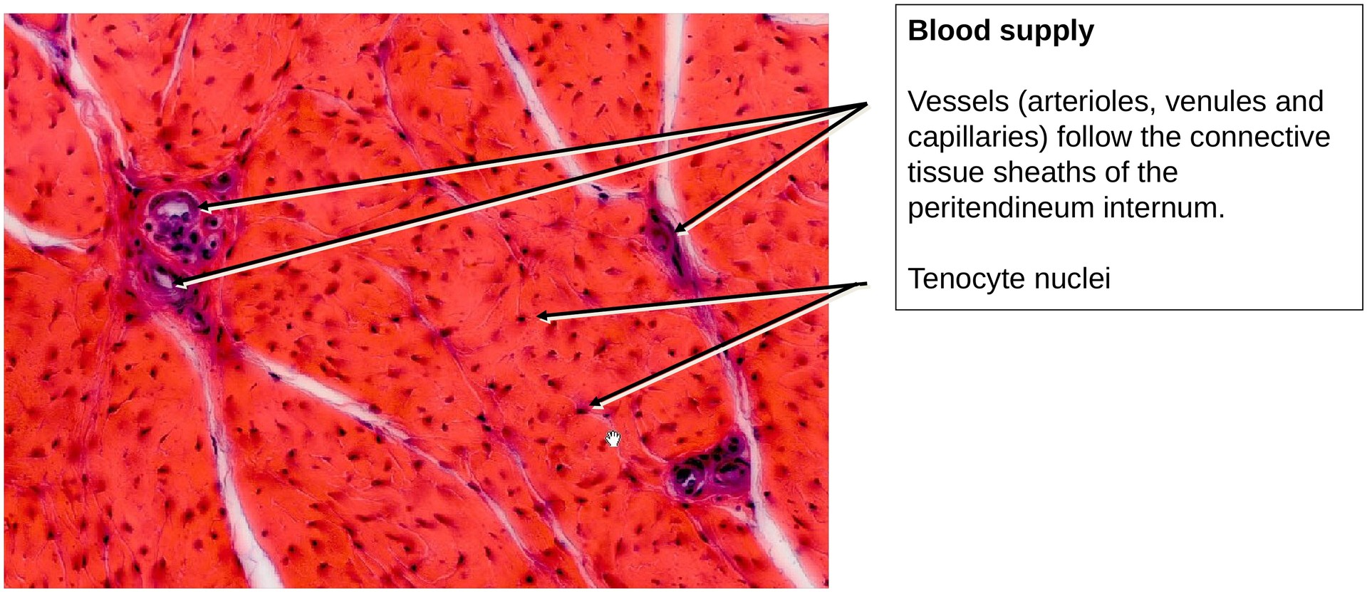Collagen fibers (Tendon, transverse section)