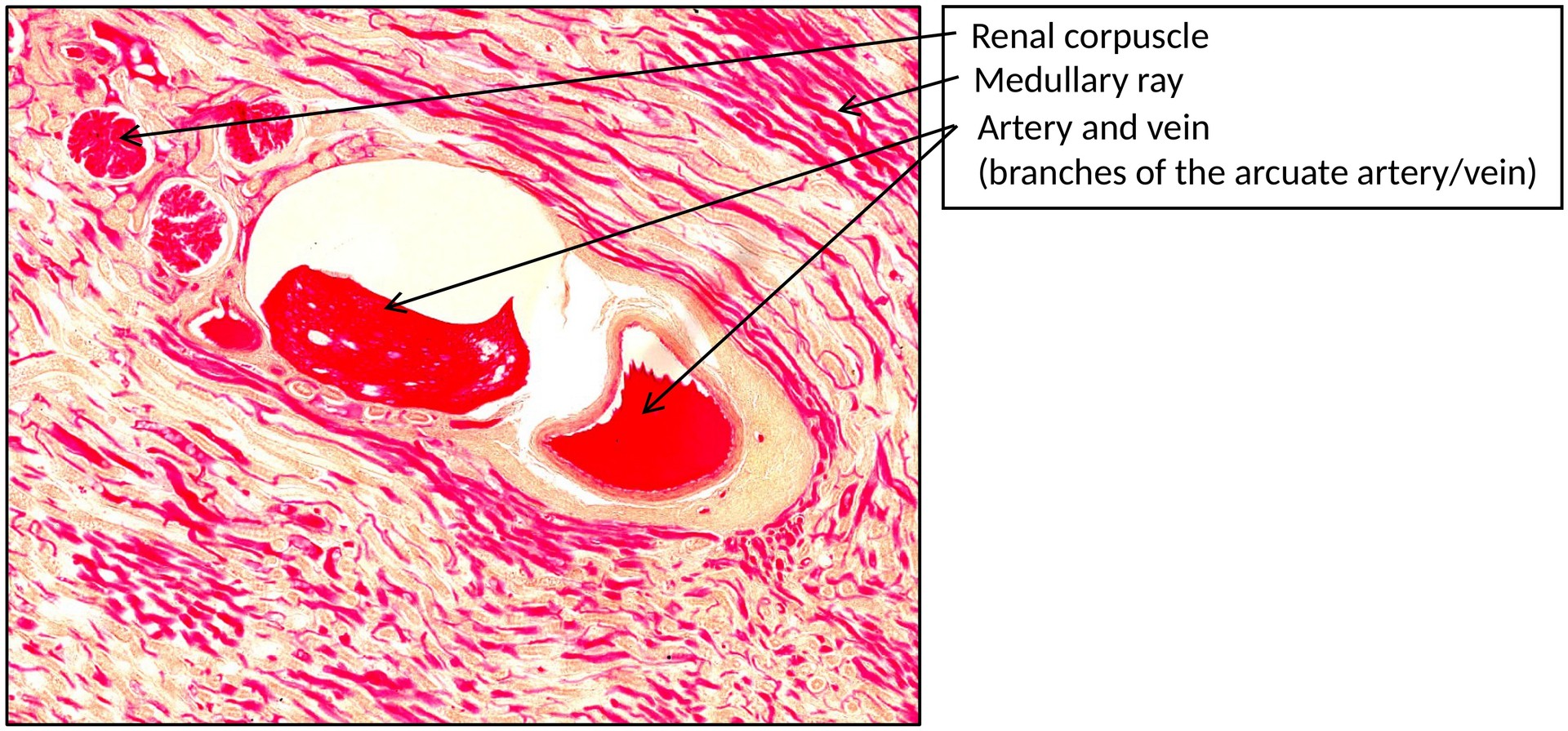 Kidney with ink injection
