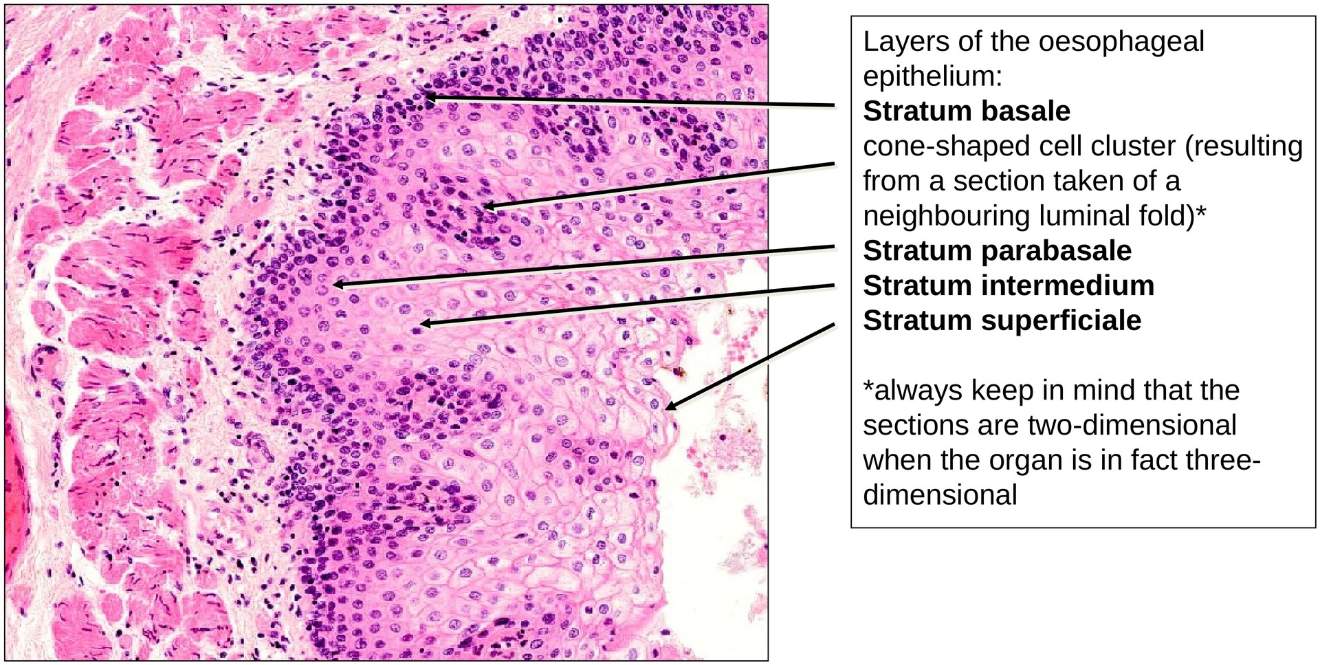 Stratified squamous epithelium (Oesophagus)