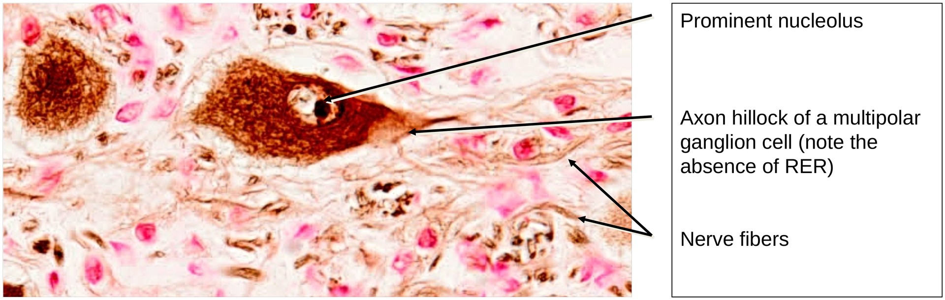 Sympathetic ganglion