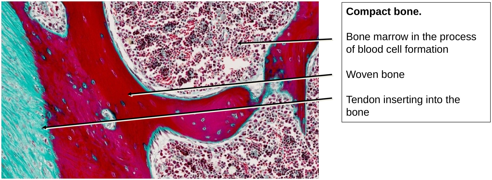 Ossification, perichondral (Finger)