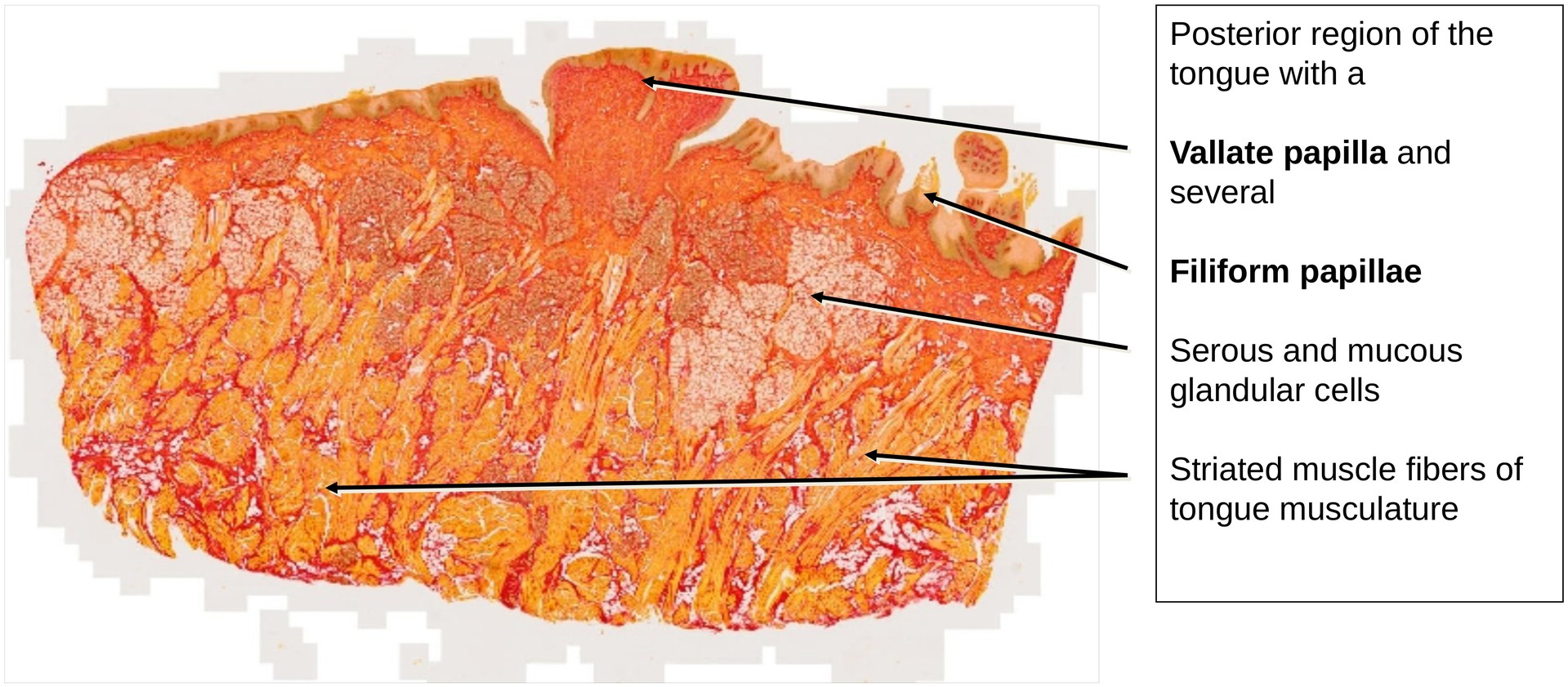 Taste bud, vallate papilla