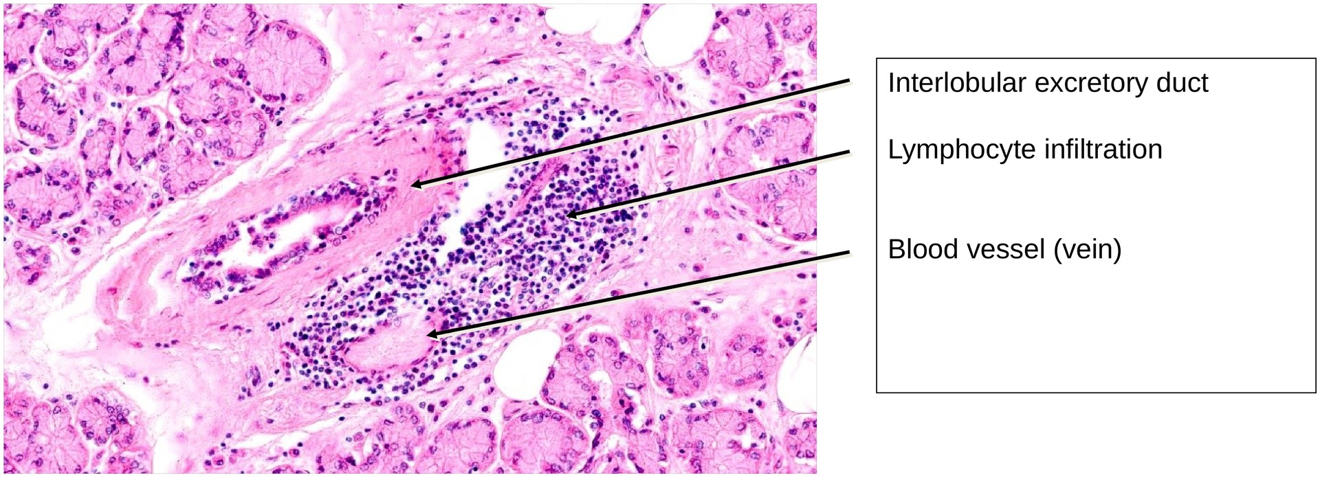 Lacrimal gland