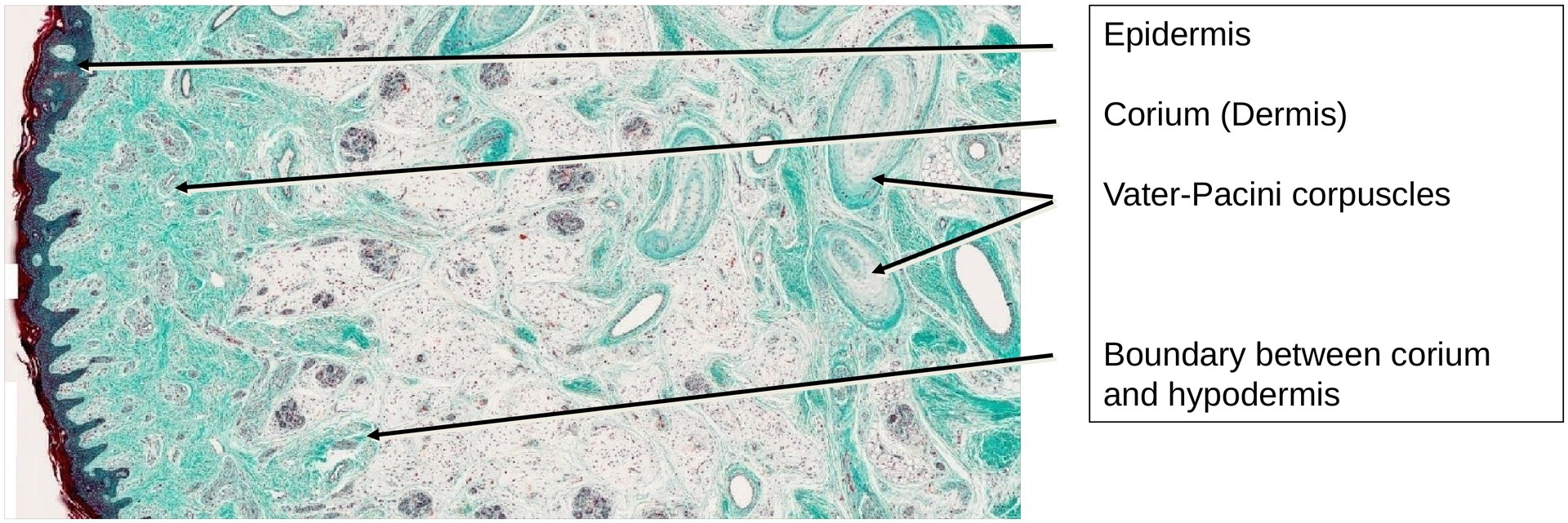 Ossification, perichondral (Finger)