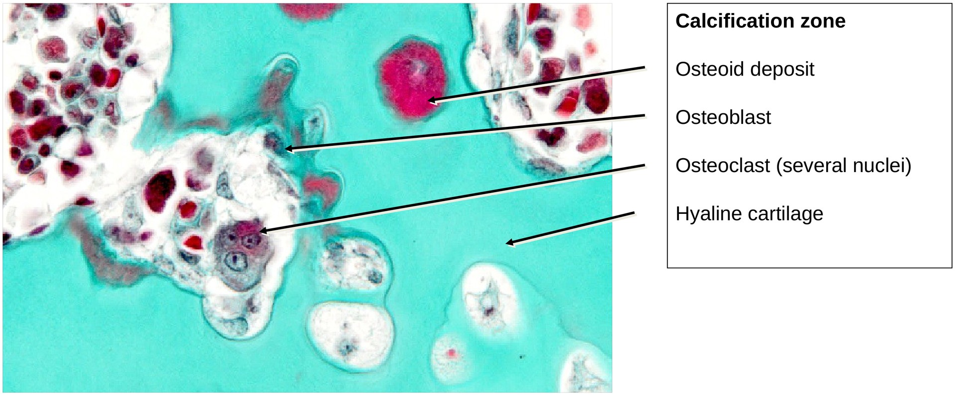 Ossification, perichondral (Finger)