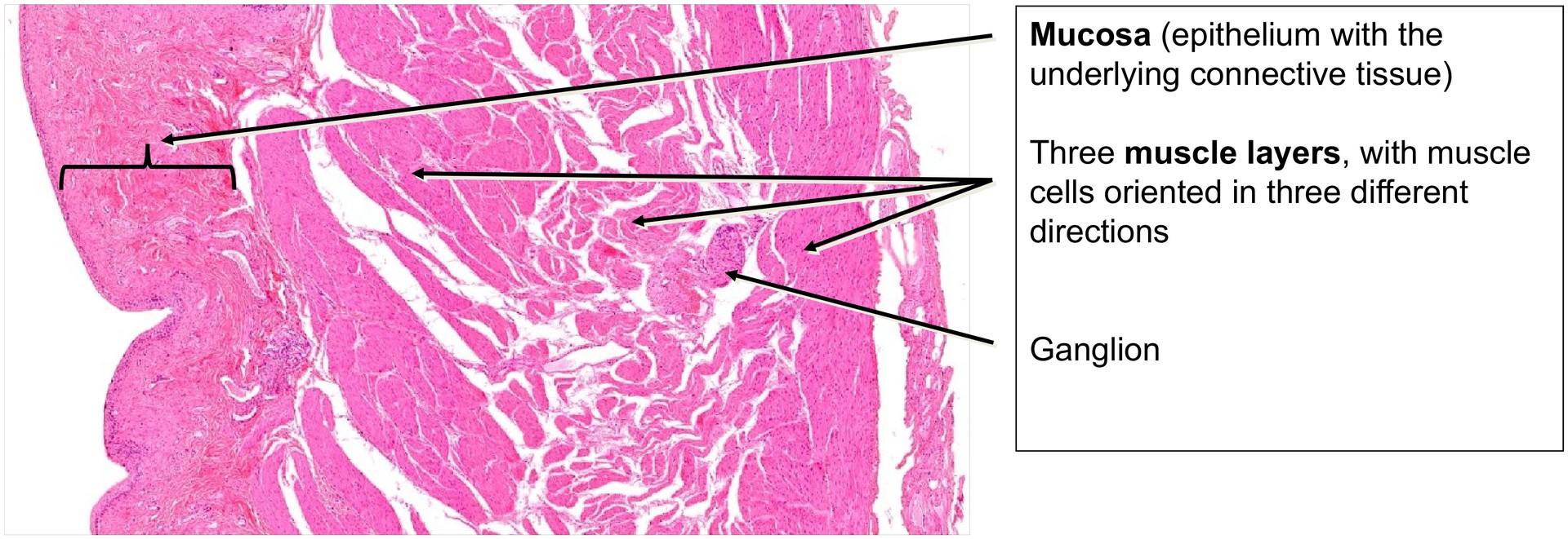 Urinary bladder