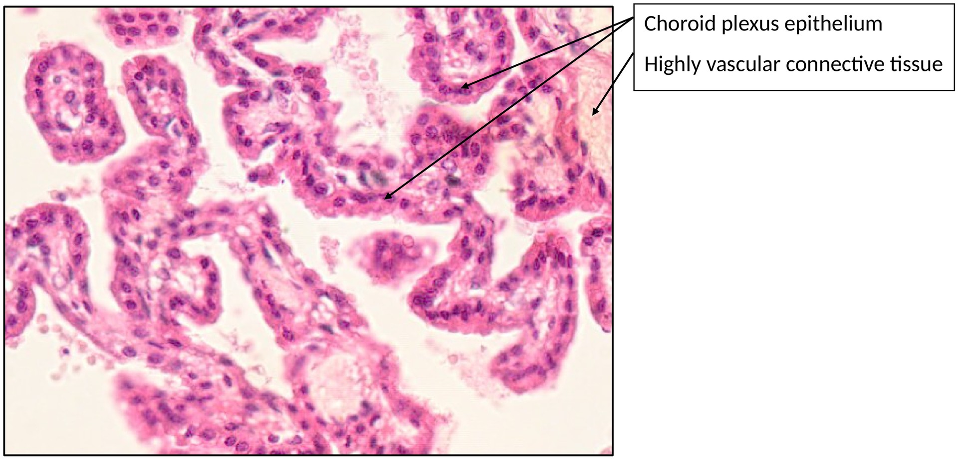 Choroid plexus