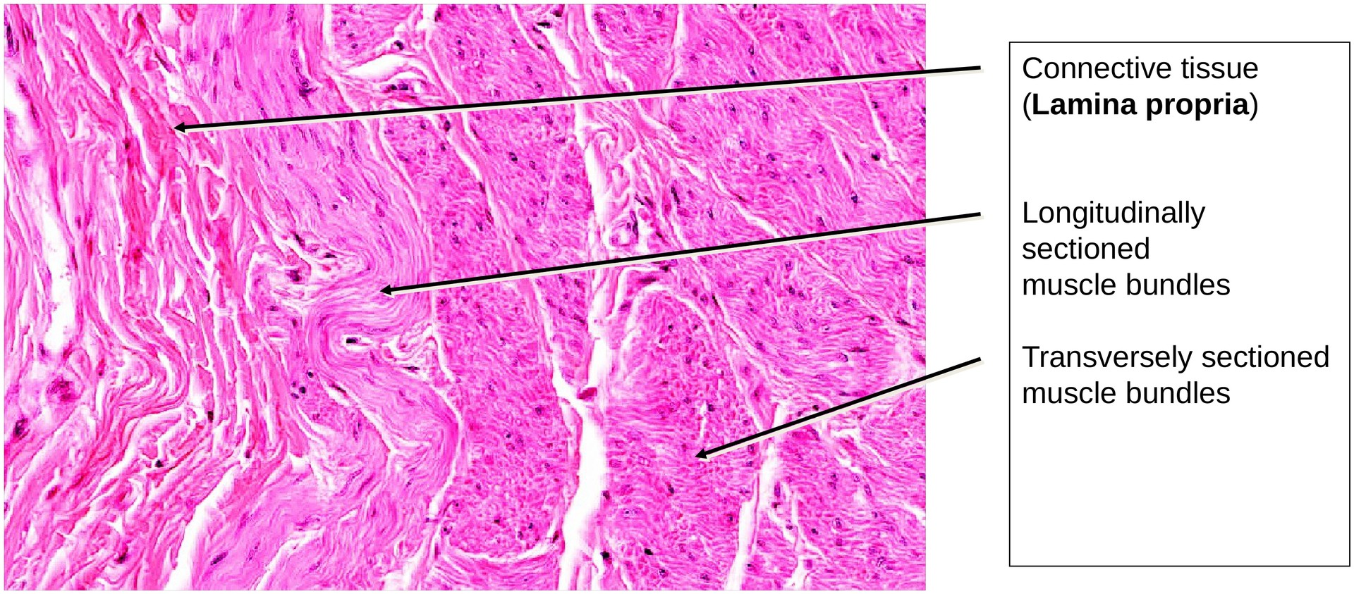 Transitional epithelium (urinary bladder)