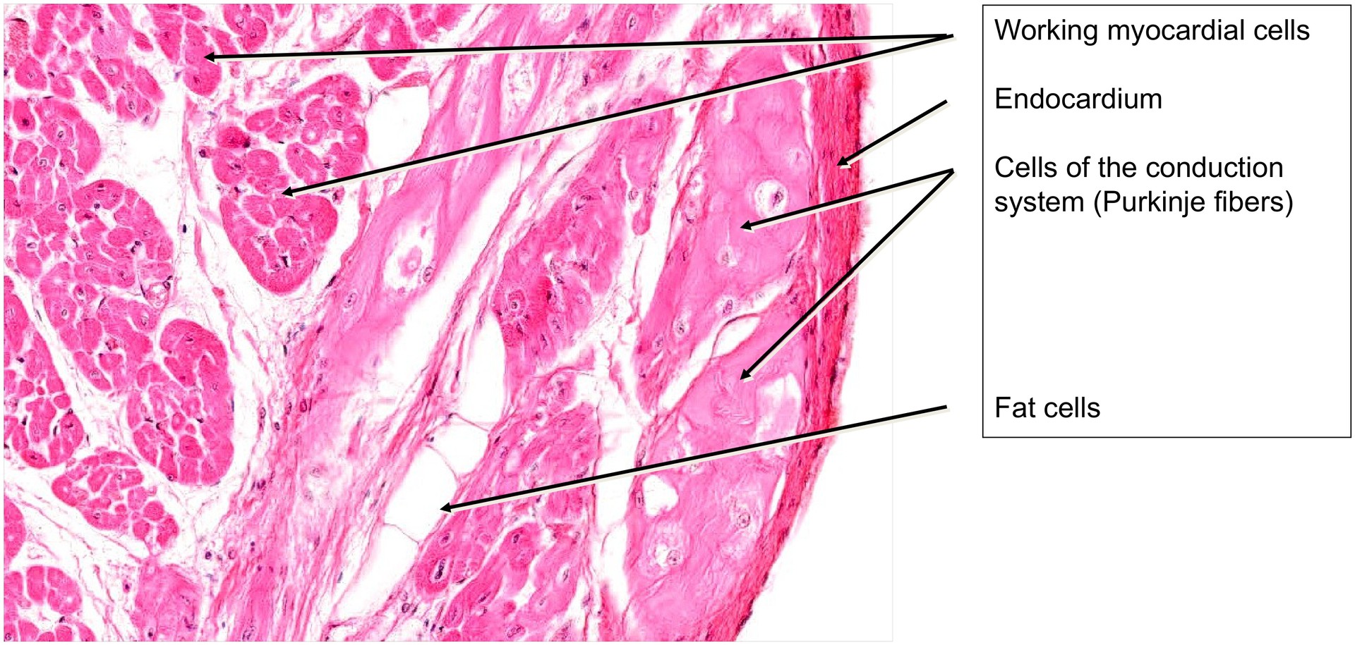 Cardiac conduction system