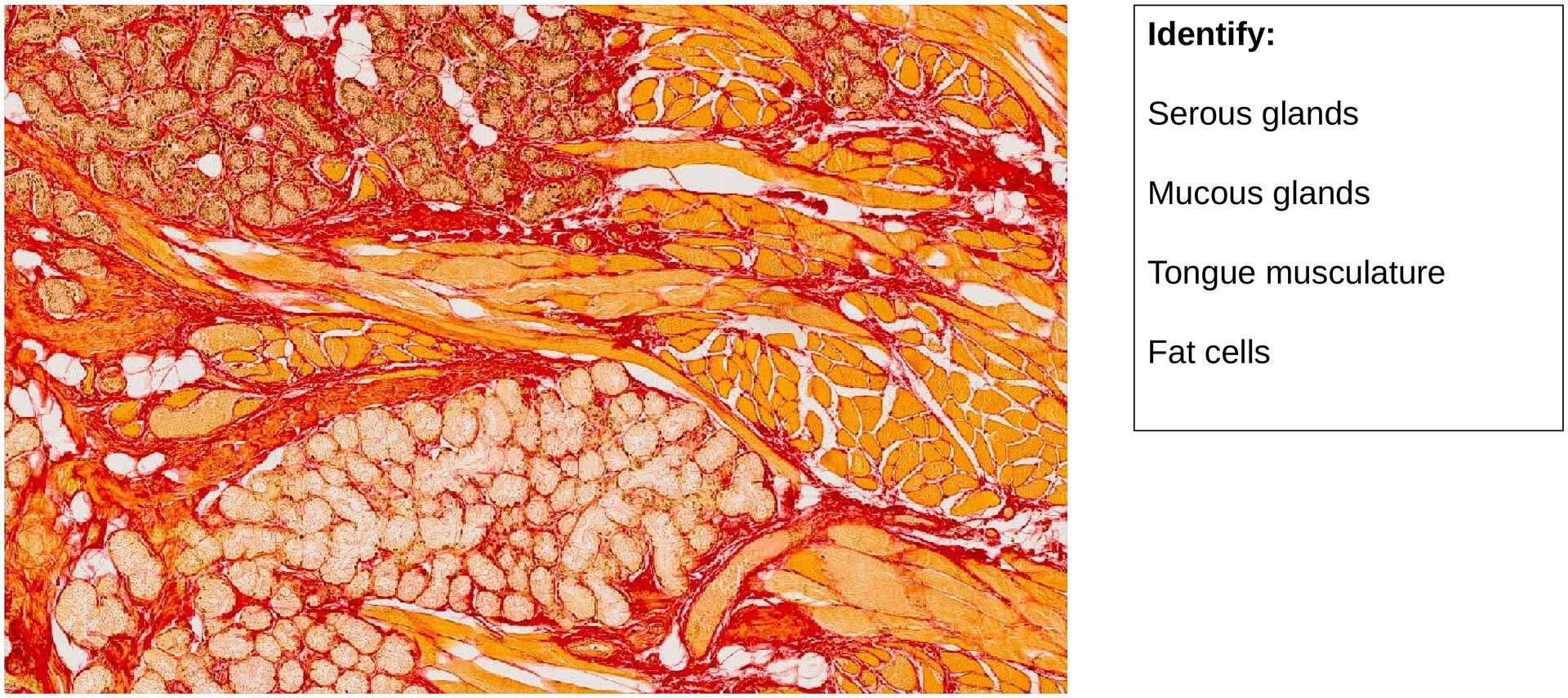 Taste bud, vallate papilla