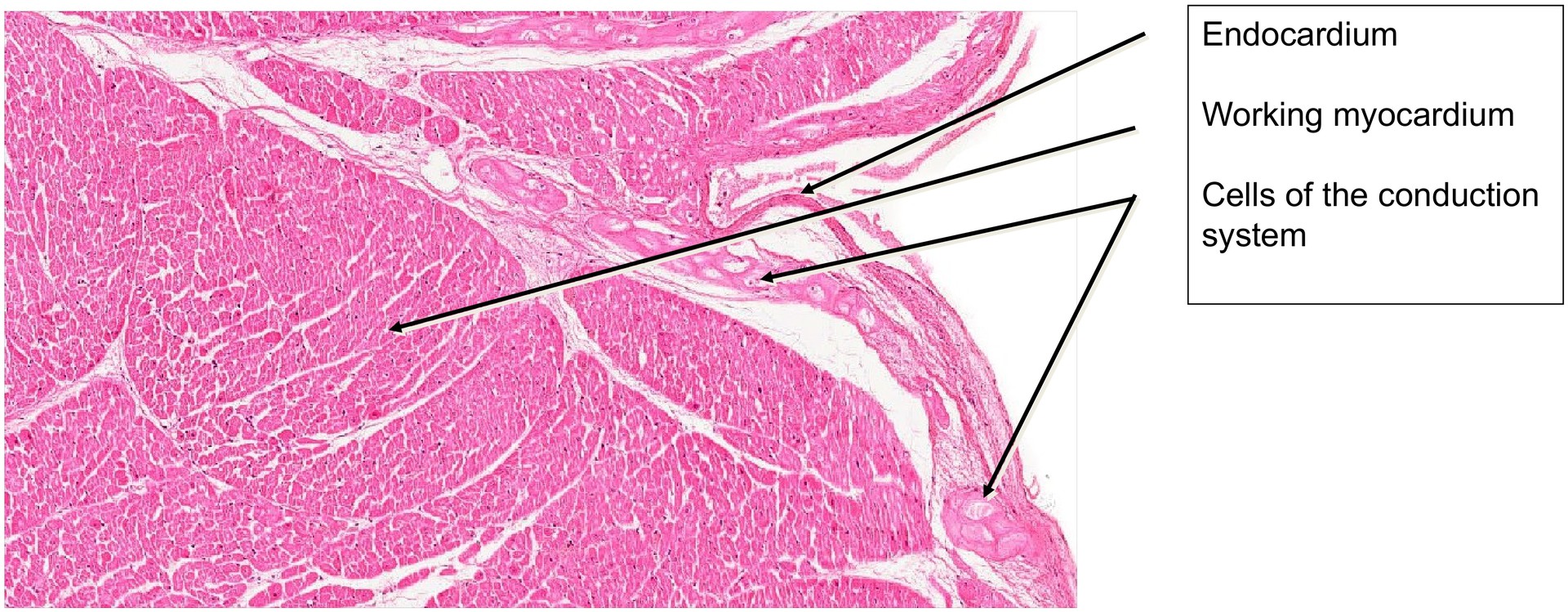 Cardiac conduction system