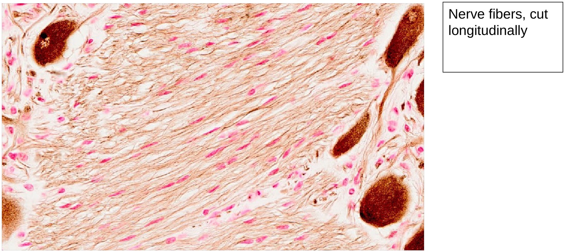 Sympathetic ganglion