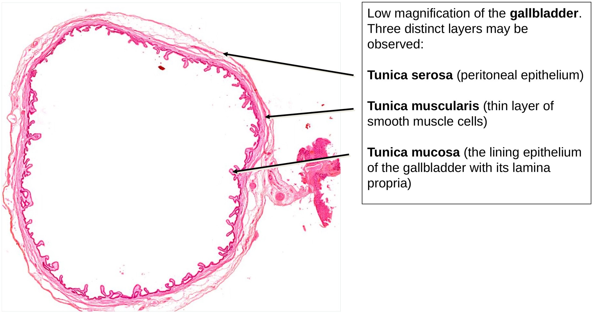 Gallbladder