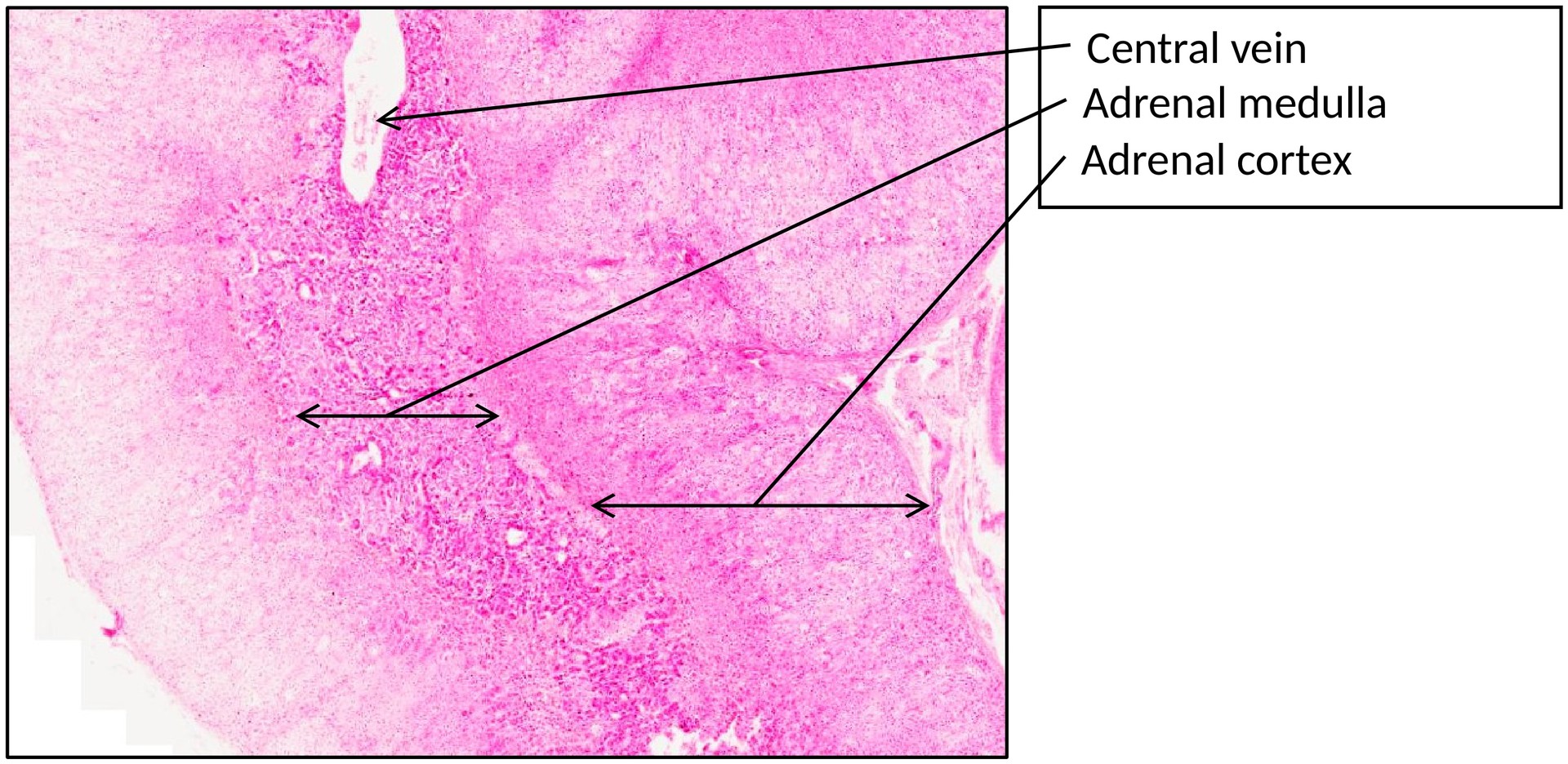 Adrenal gland
