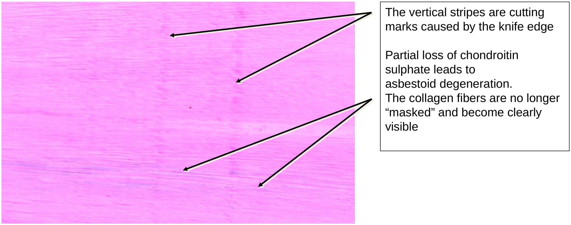 Hyaline cartilage (Rib)