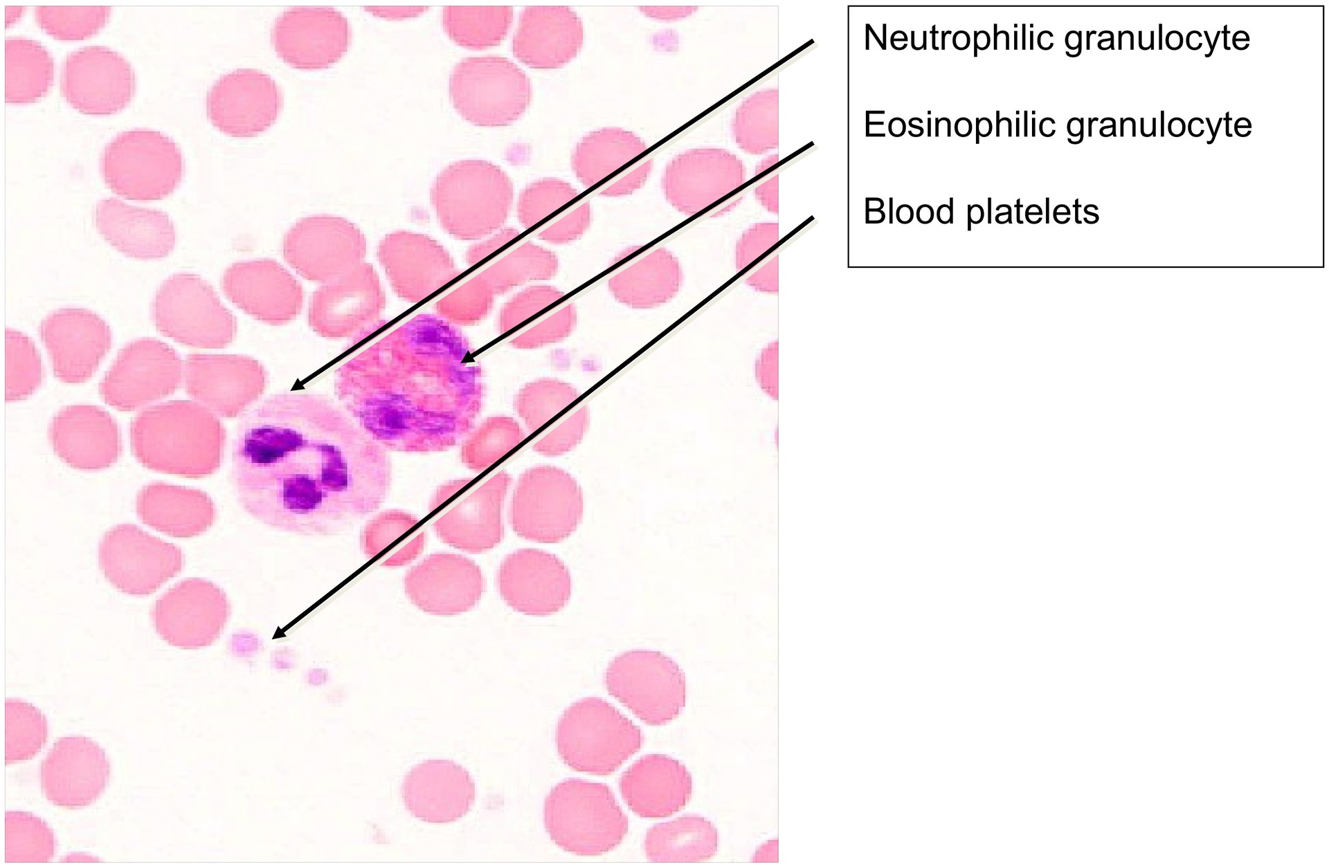 Blood smear