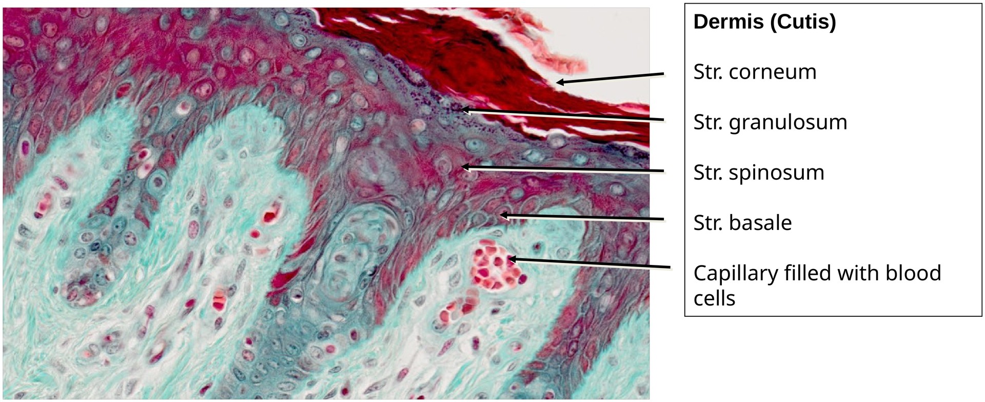 Ossification, perichondral (Finger)
