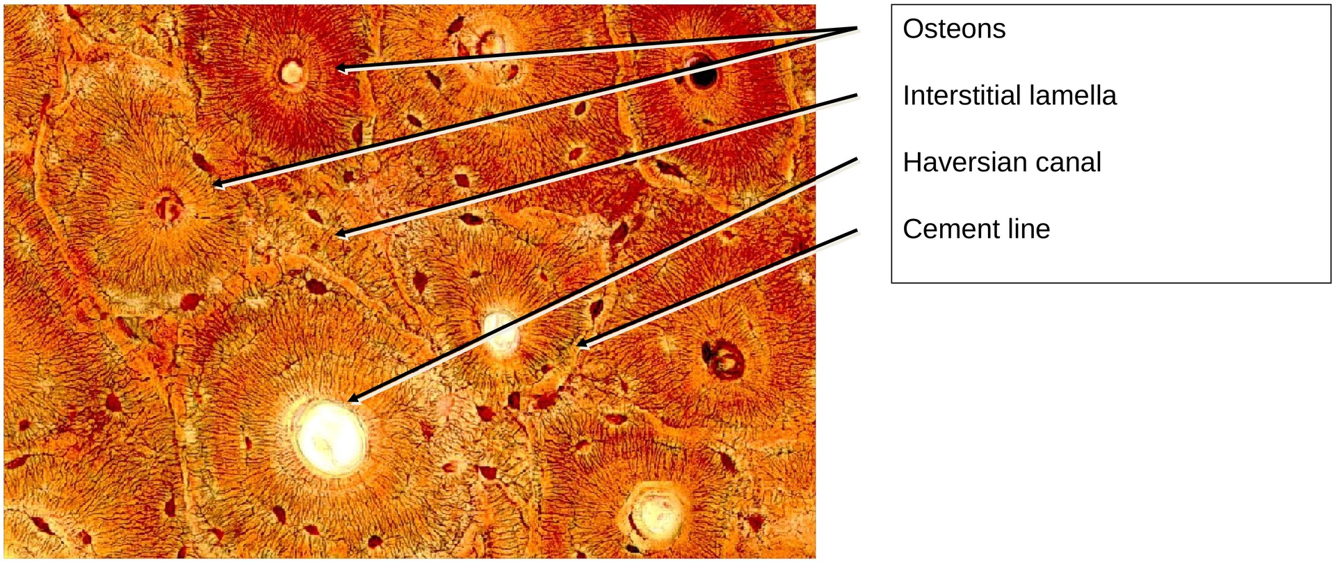 Lamellar bone (Dog, Tibia)