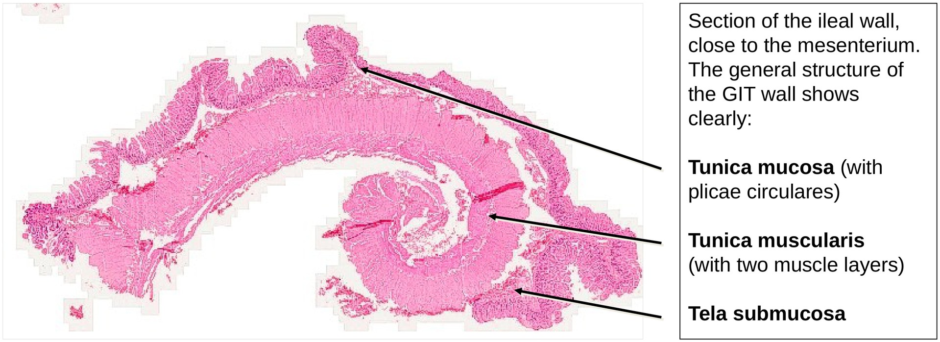 Ileum, Human 1