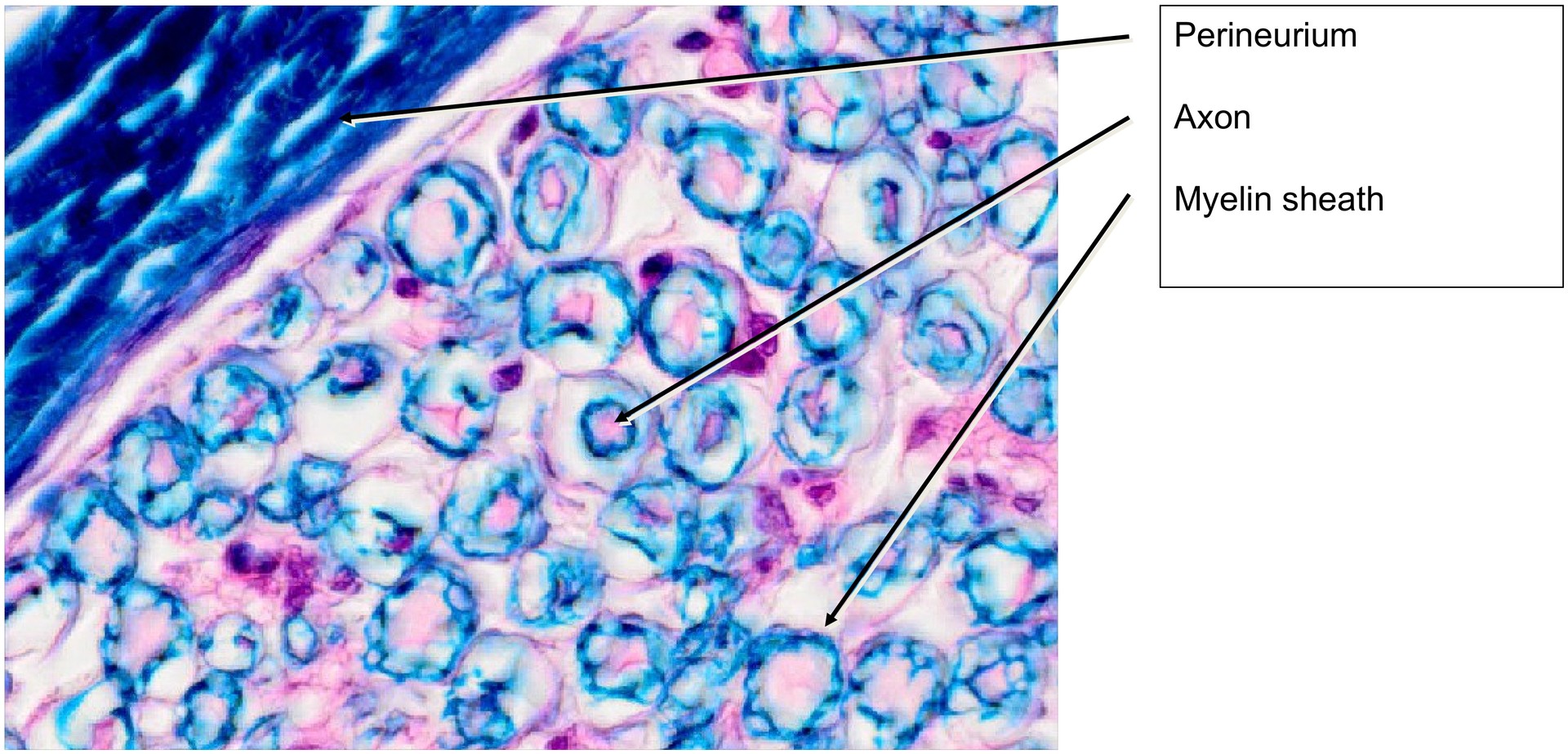 Peripheral nerve (sciatic nerve)