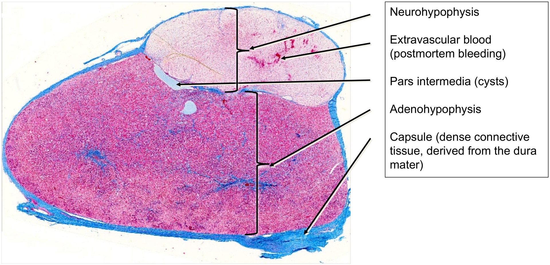 Pituitary gland (Hypophysis)