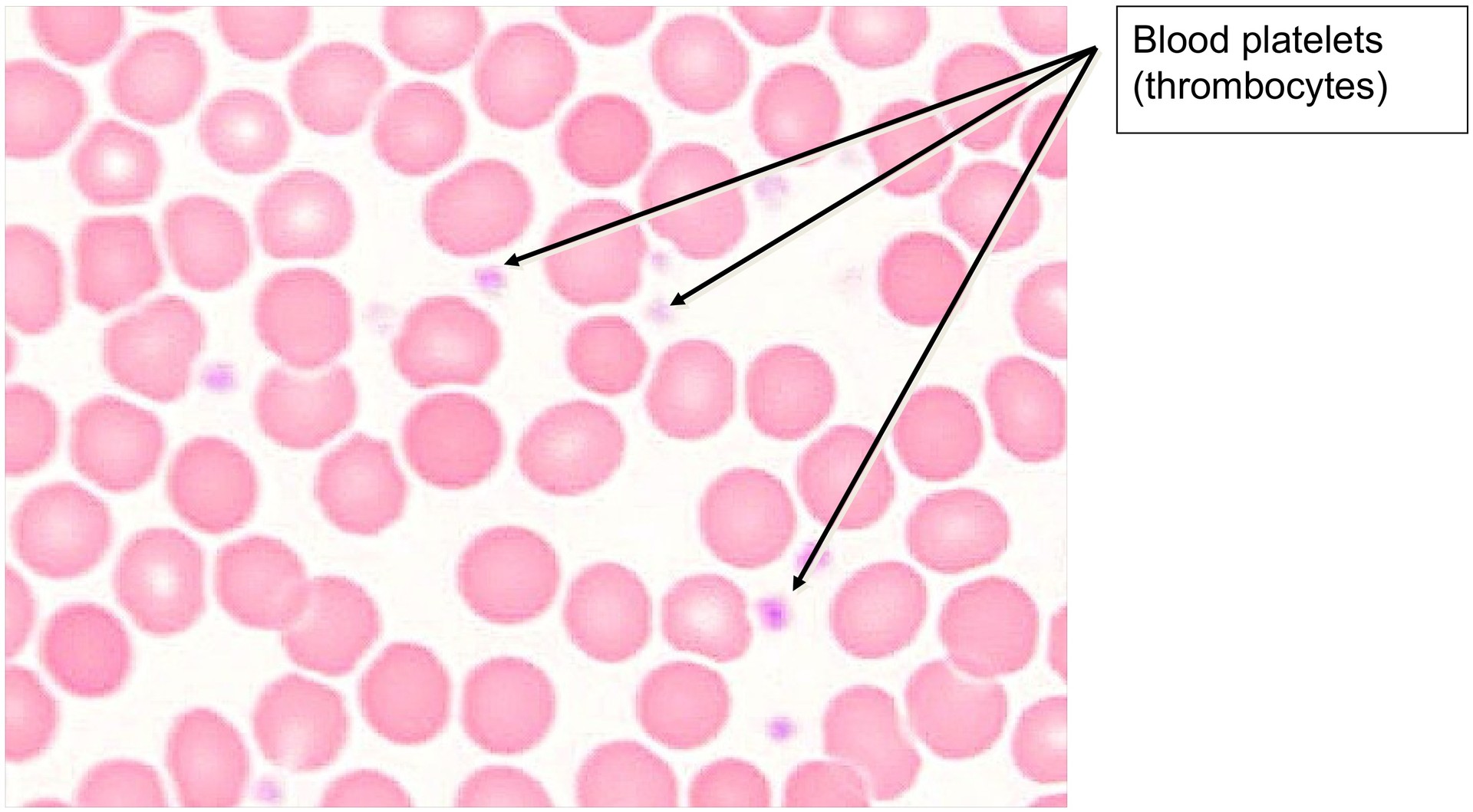 Blood smear