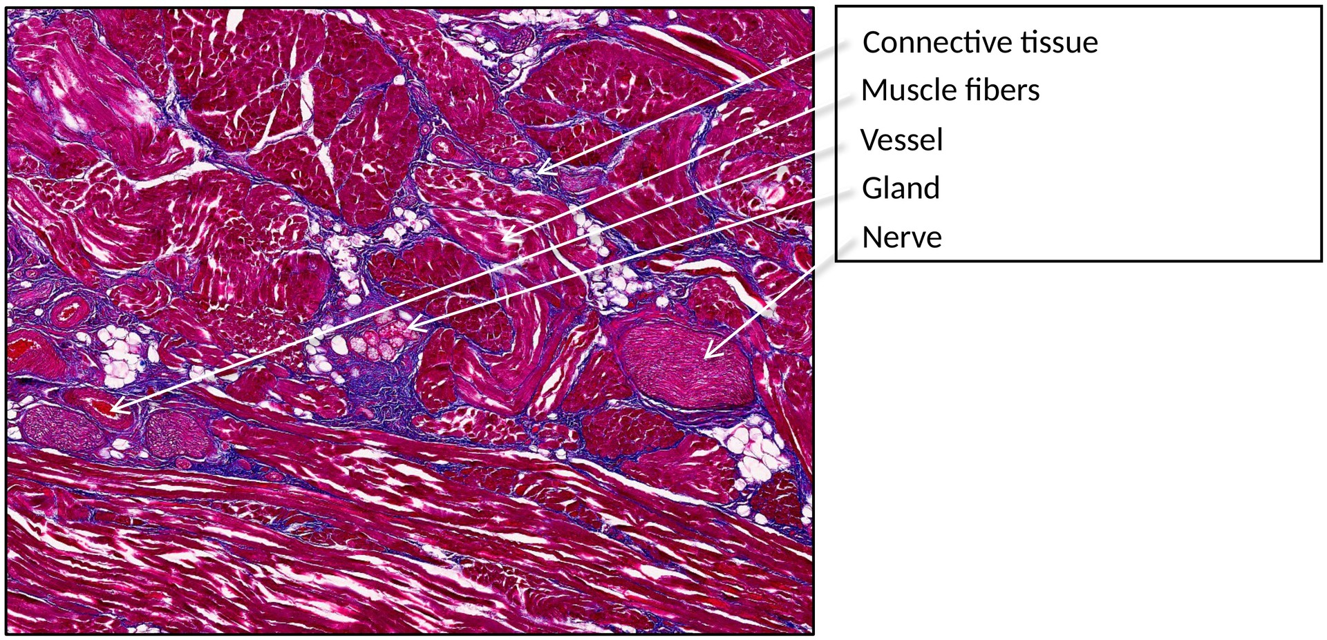 Tongue filiform papillae