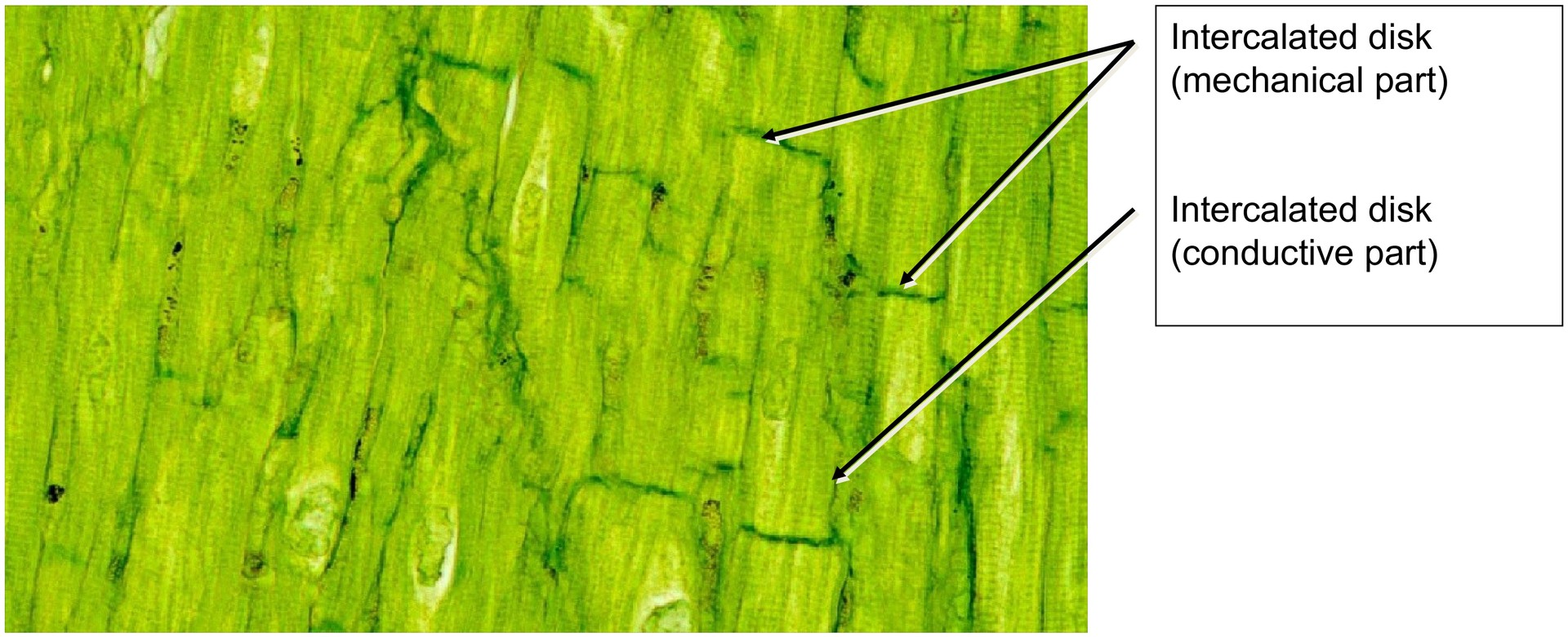 Intercalated discs (Heart muscle)