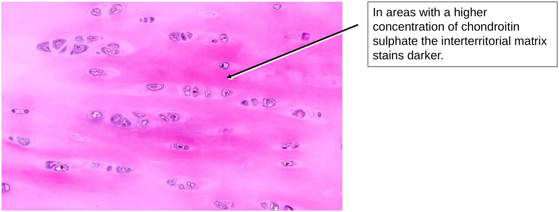 Hyaline cartilage (Rib)