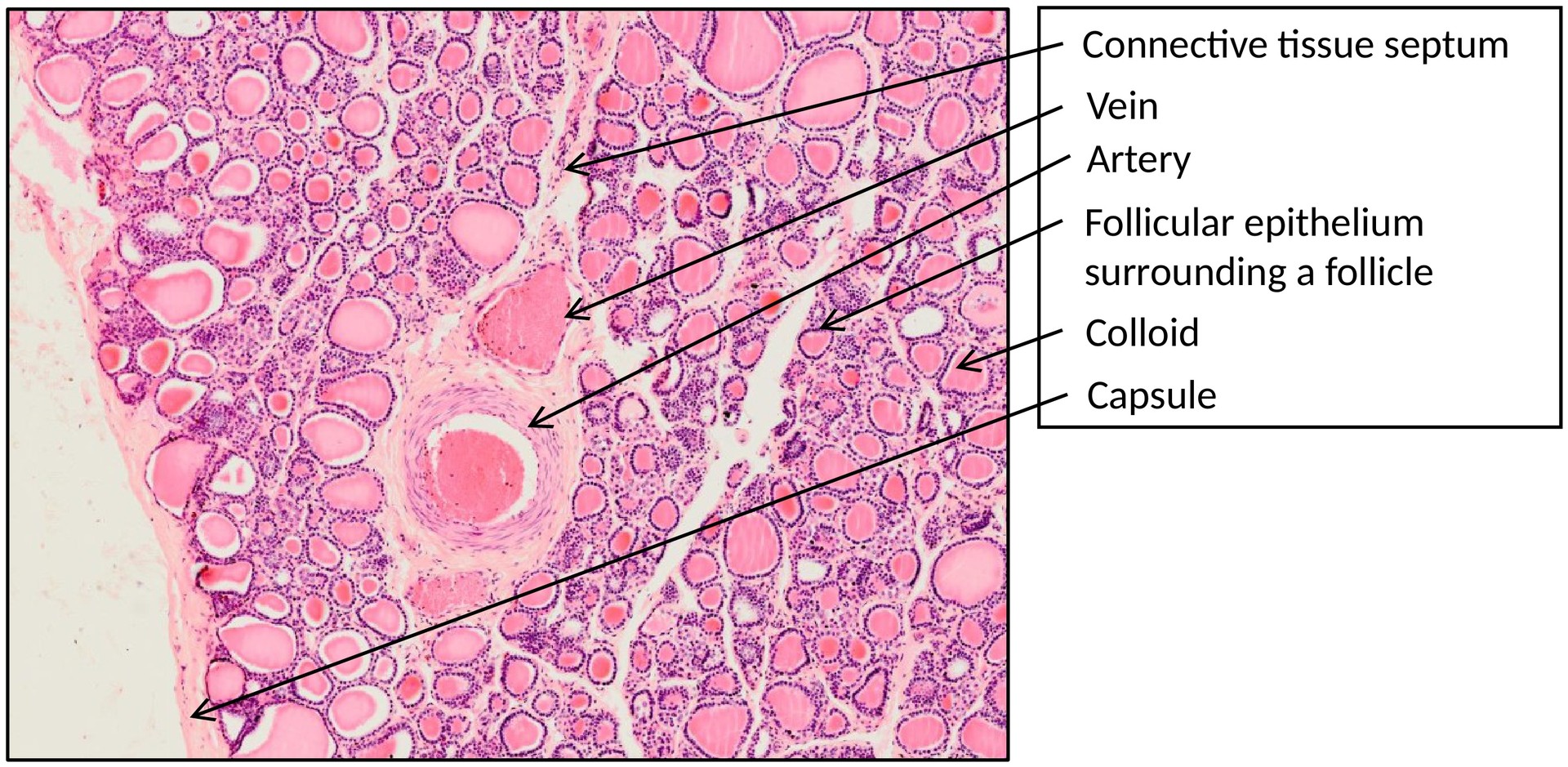 Thyroid gland