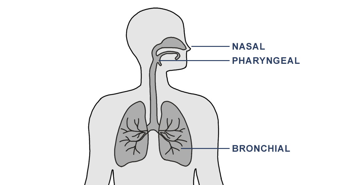Figure depicting human body with arrows pointing to nose, pharynx and bronchi. Refers to the symptoms caused by rhinovirus.