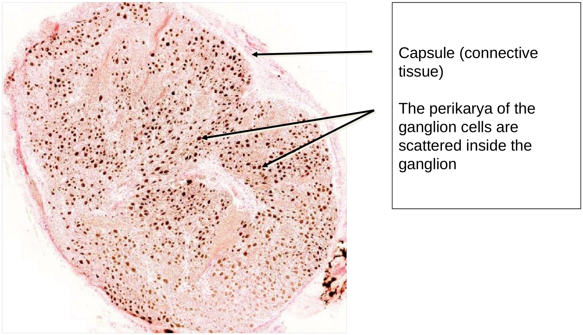 Sympathetic ganglion