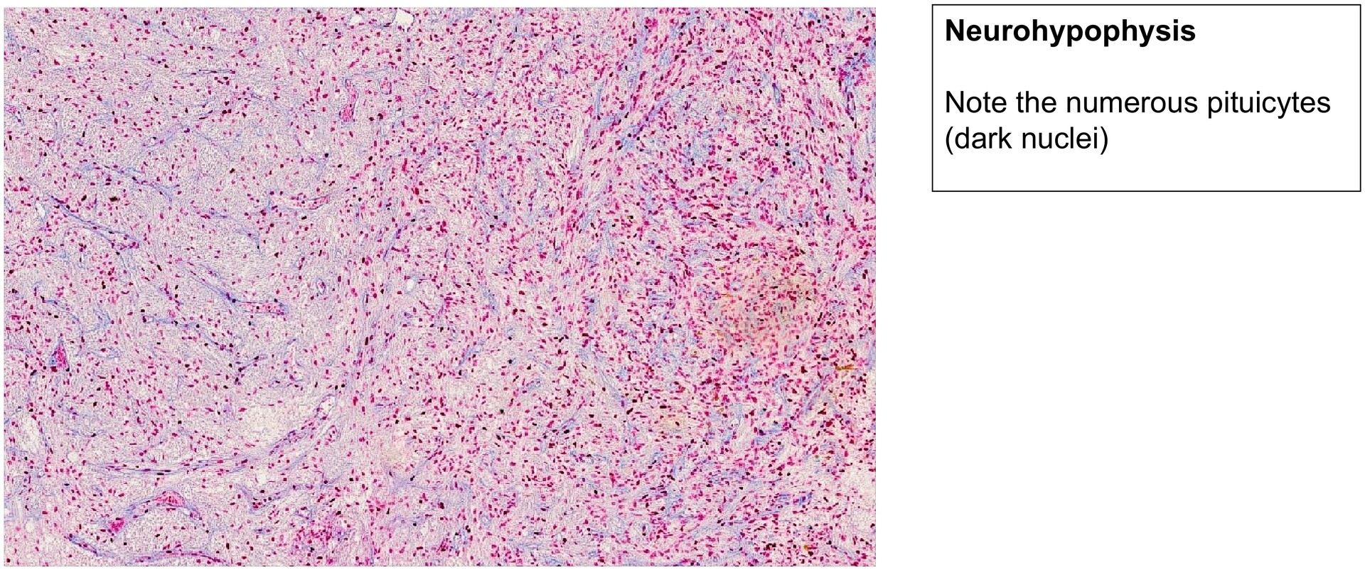 Pituitary gland (Hypophysis)