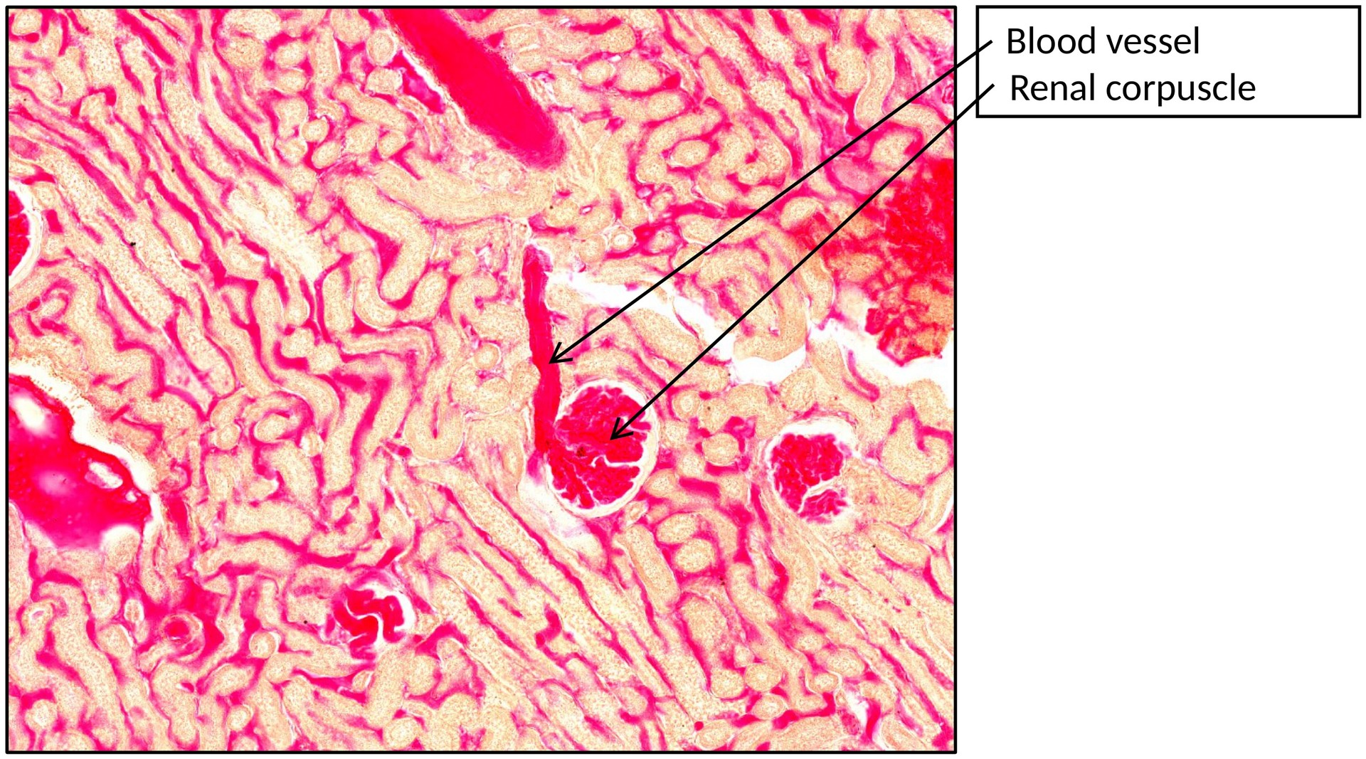 Kidney with ink injection
